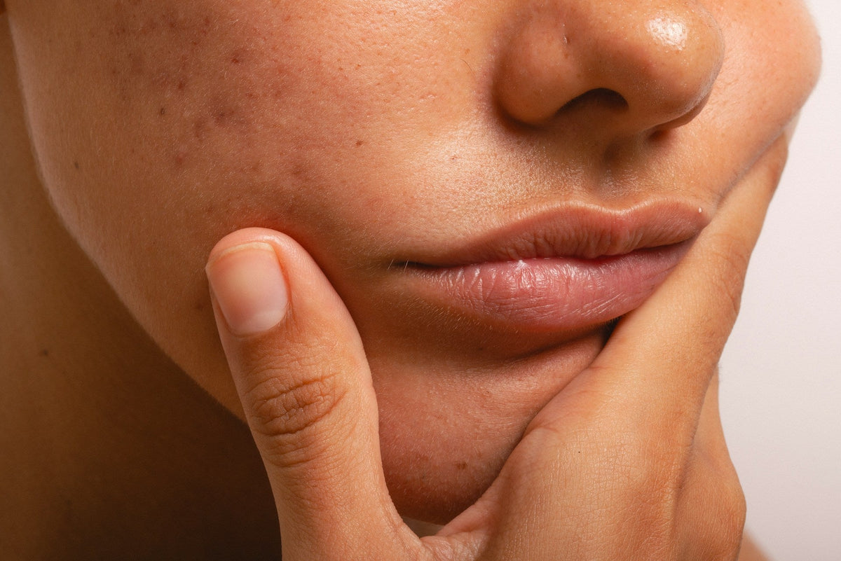 Decoding Mineral-Based Skincare for Skin Barrier Repair